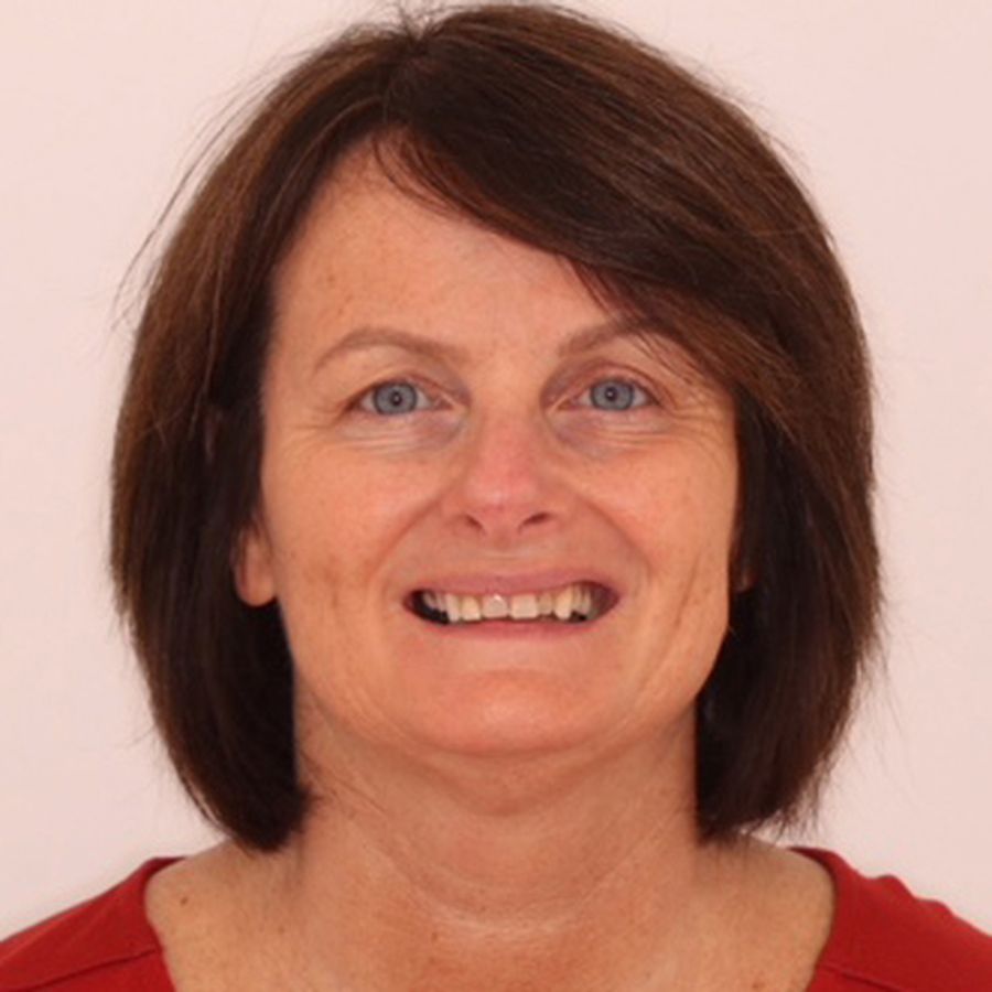 Elaine Collins - before white fillings treatment - 3Dental